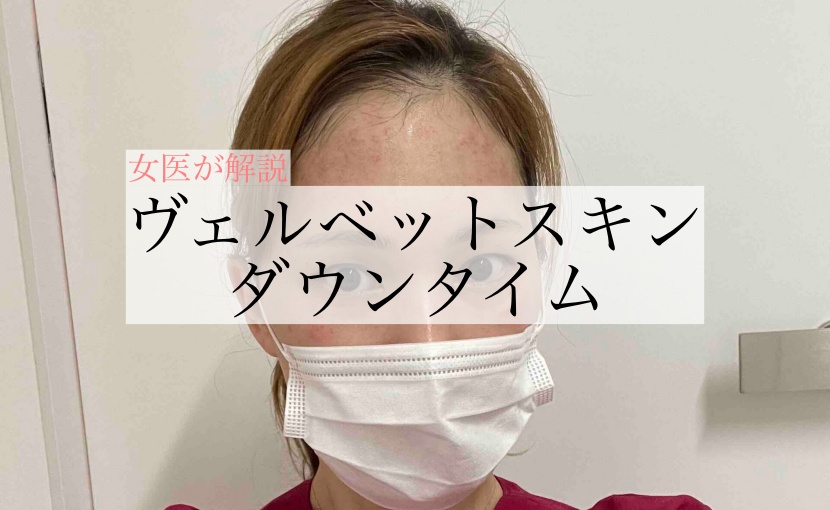 ヴェルベットスキン