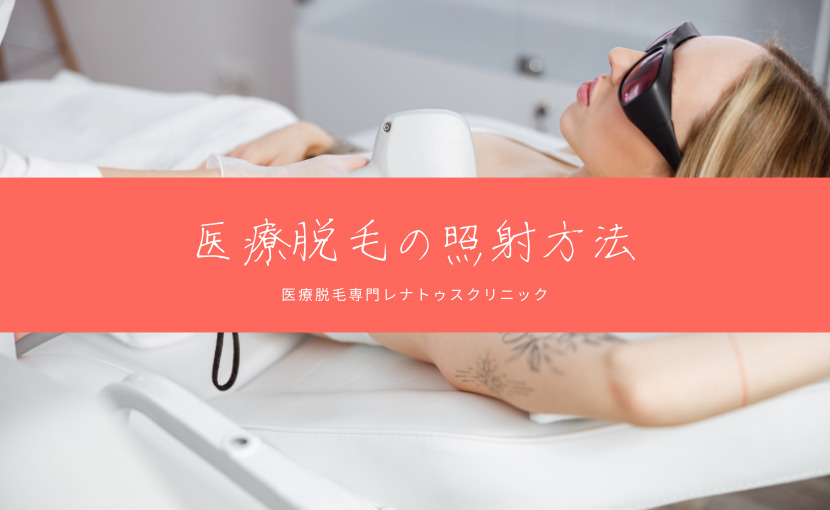 医療脱毛の照射方法