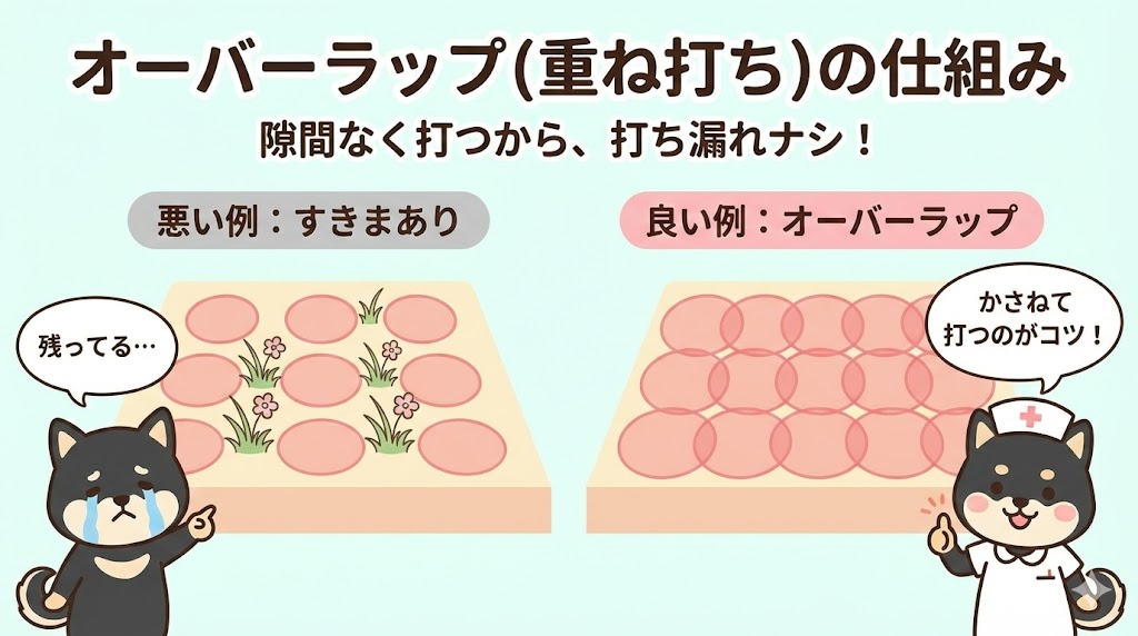 医療脱毛の照射方法と注意点
ショット式・蓄熱式・吸引式の違いと「技術」の真実