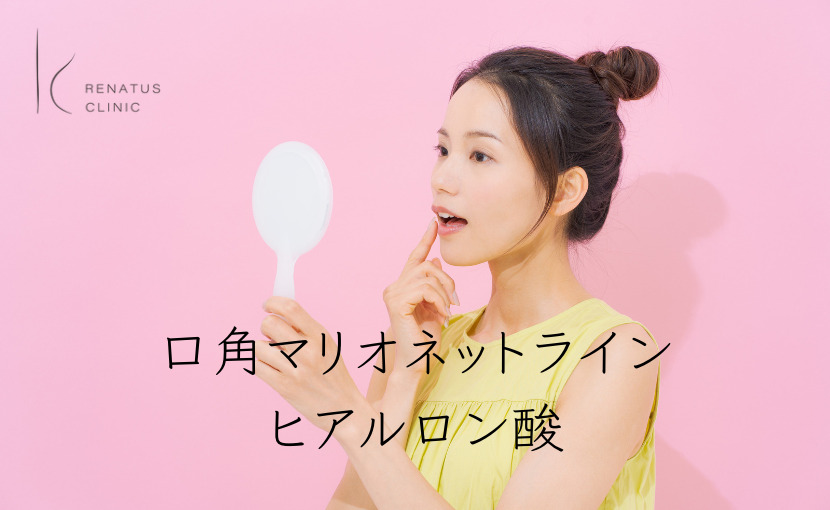 口角マリオネットライン