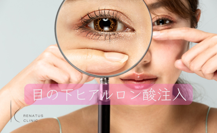 目の下眼窩縁ヒアルロン酸注入