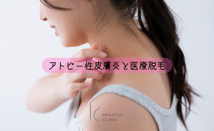 アトピー性皮膚炎と医療脱毛