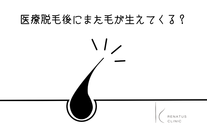 医療脱毛また毛が生えてくる
