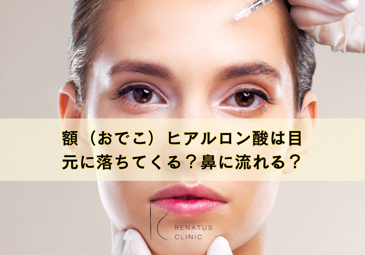 おでこ落ちてくる