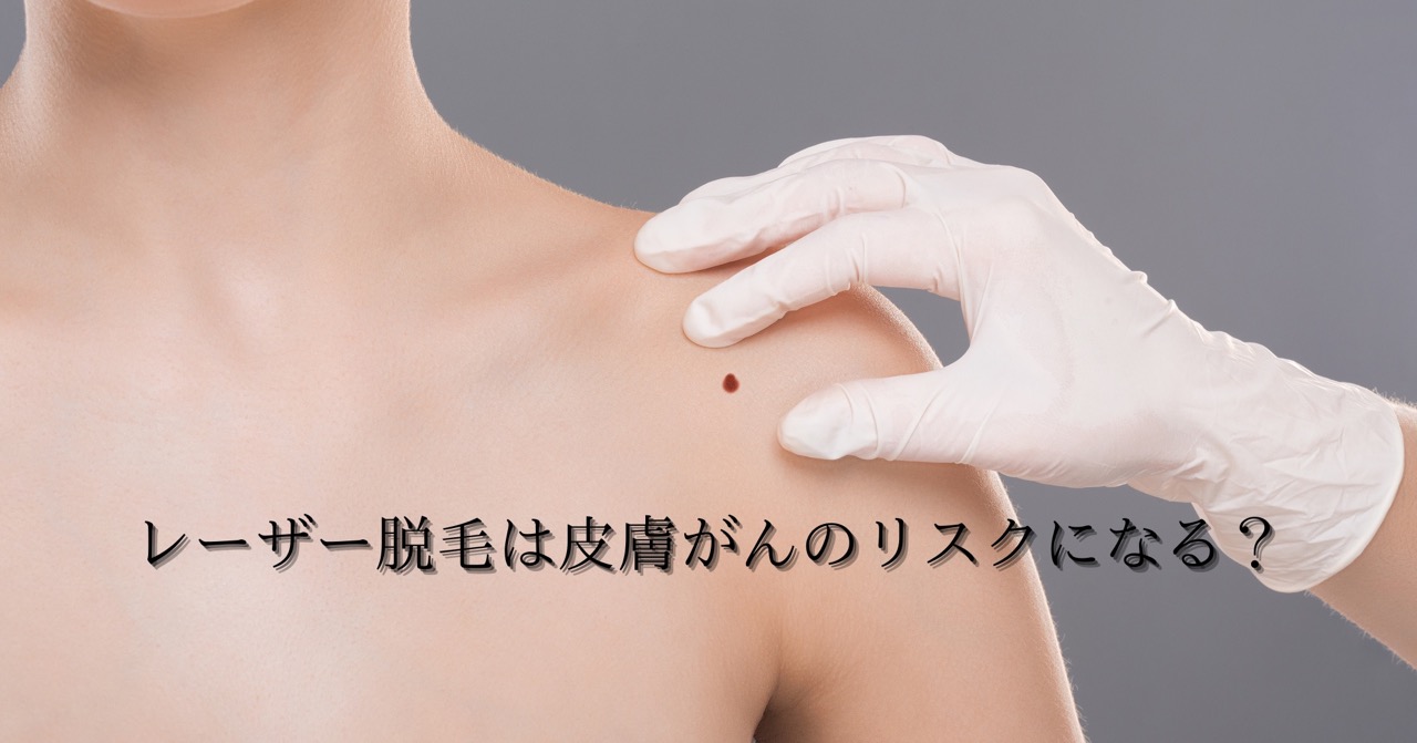 レーザー脱毛は皮膚がんのリスクになる？