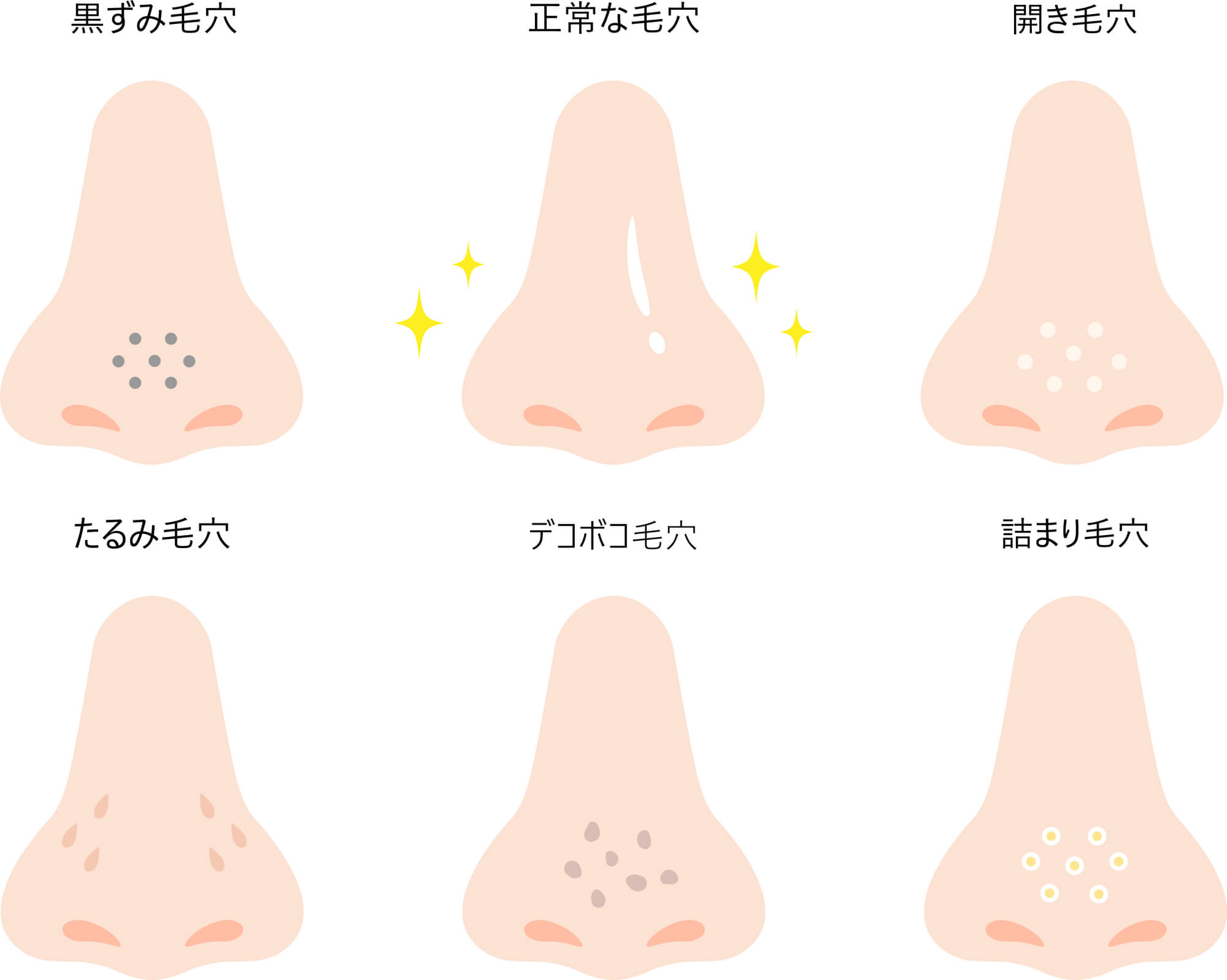 さまざまな鼻の毛穴