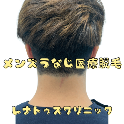 メンズうなじ脱毛