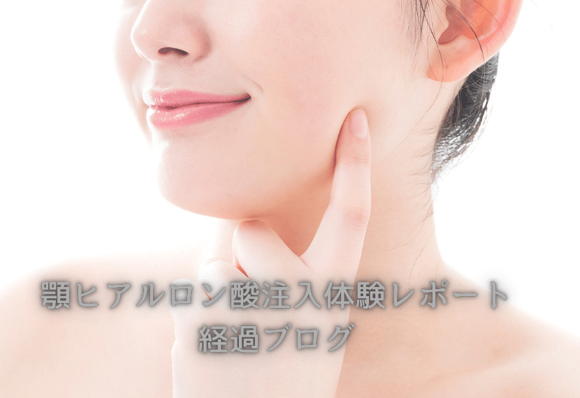 顎ヒアルロン酸　症例写真　体験レポート　注入　経過