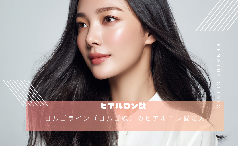 ゴルゴライン（ゴルゴ線）のヒアルロン酸注入