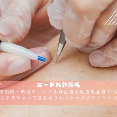 東京田町・新宿のニードル針医療脱毛眉毛全身VIOが 安いおすすめメンズ含むならレナトゥスクリニック東京田町新宿院