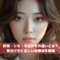 肝斑・シミ・そばかすの違いとは？見分け方と正しい治療法を解説