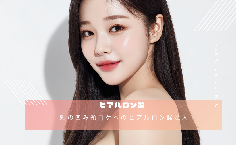 頬の凹み頬コケへのヒアルロン酸注入