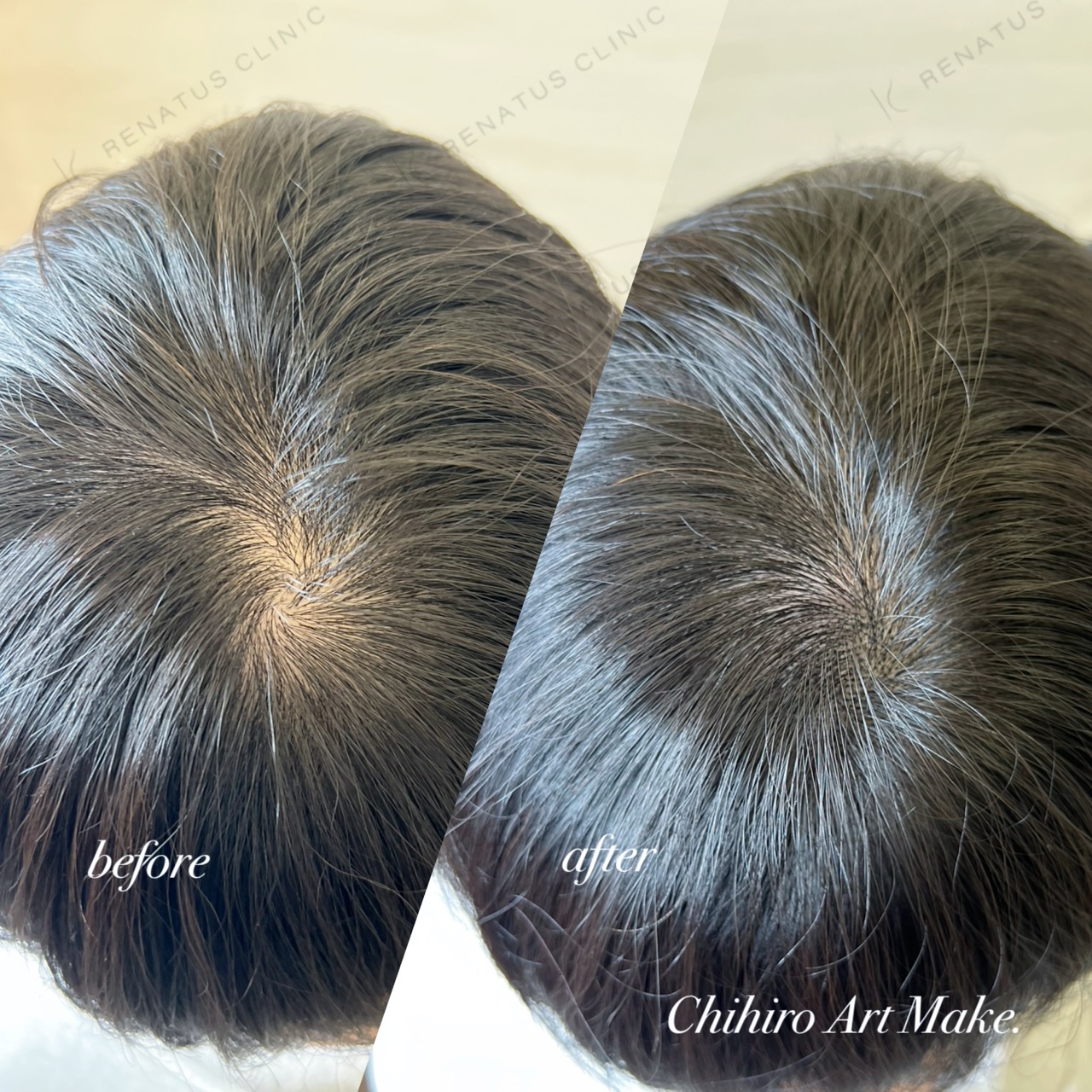 仙台頭皮アートメイク上手い安い口コミ良い