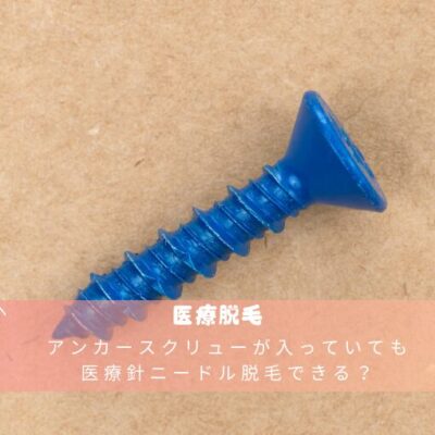 アンカースクリューが入っていても医療針ニードル脱毛できる？