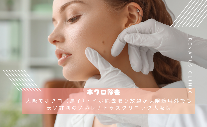 大阪でホクロ（黒子）・イボ除去取り放題が保険適用外でも安い評判のいいレナトゥスクリニック大阪院
