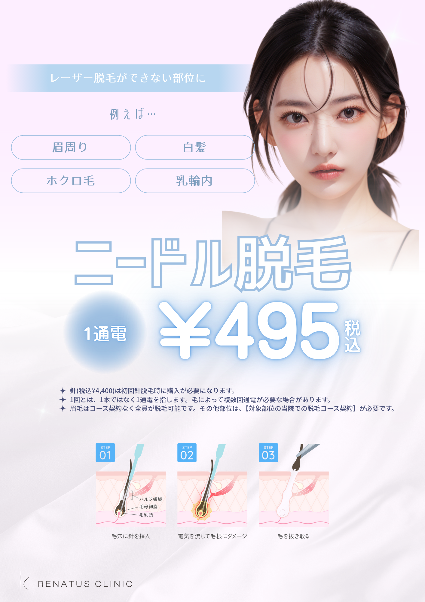 針脱毛　キャンペーン