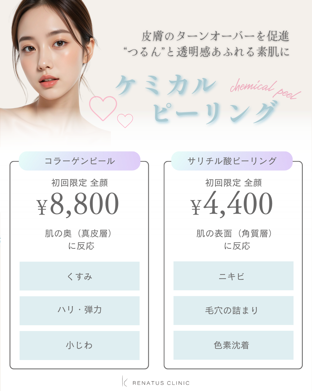 ピーリング　キャンペーン