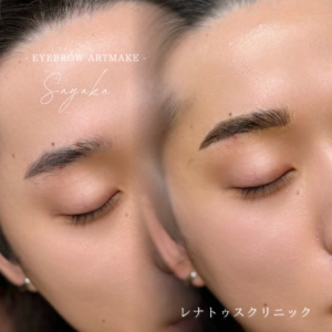 大阪のメンズアートメイクならレナトゥスクリニック 1 大阪で安い上手い眉アートメイク