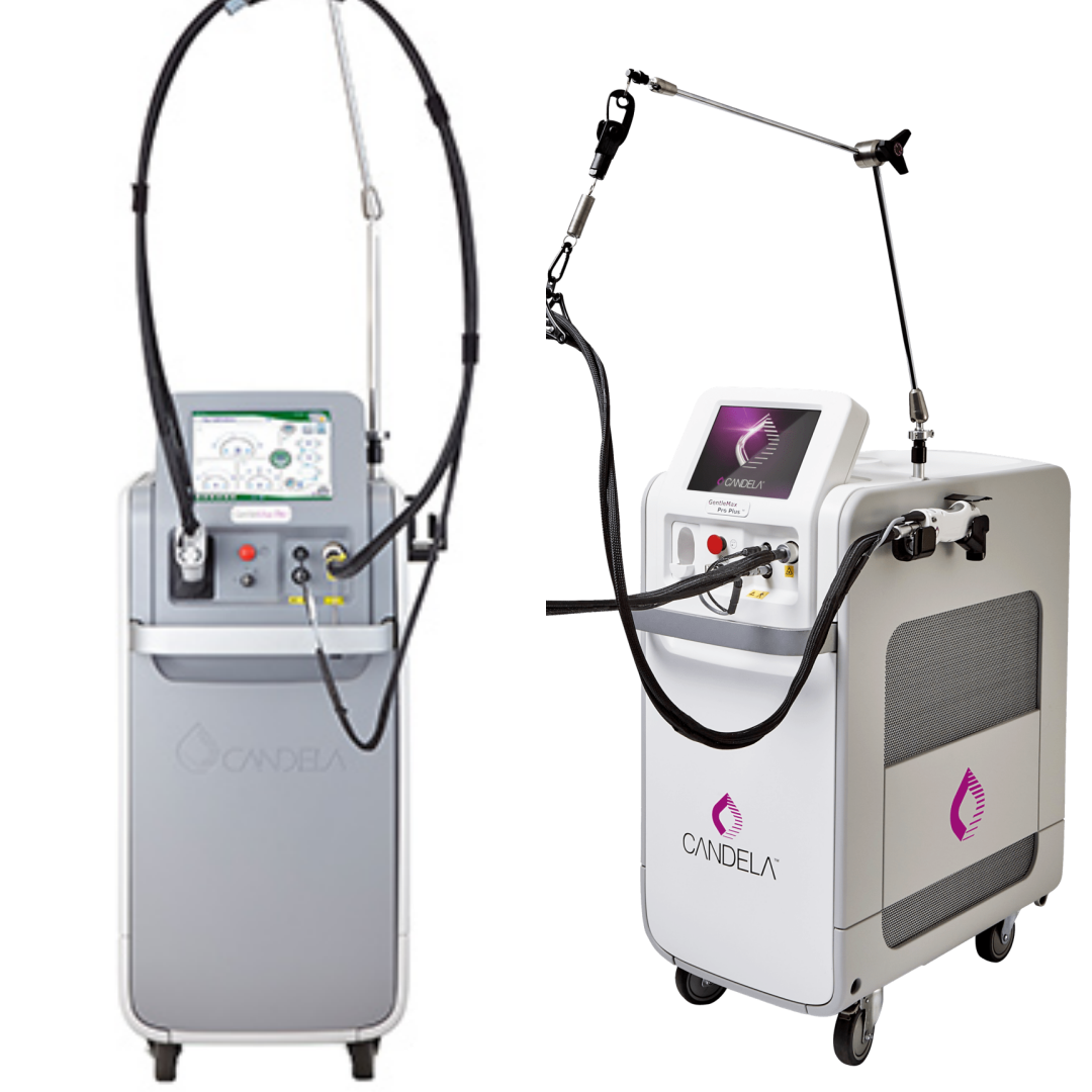 医療脱毛 16 ジェントルマックスプロプラス比較