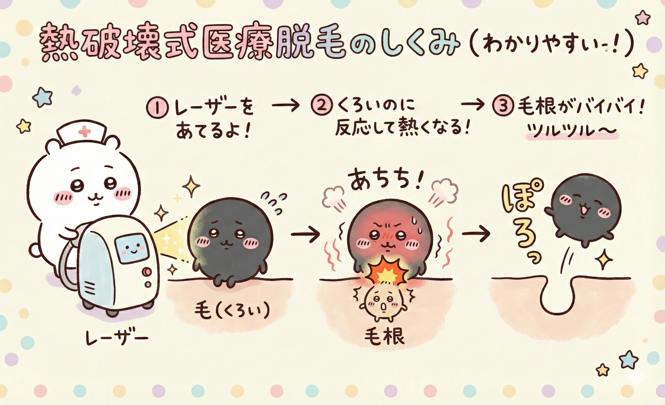 医療脱毛熱破壊式