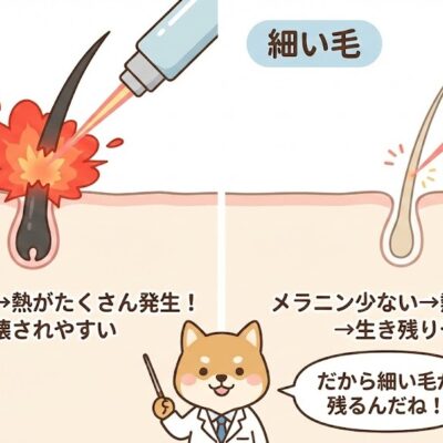 VIO脱毛で「薄くするだけ」なら何回? やりすぎた時の対処法と「毛が細くなる」医学的理由 2 脱毛で毛は細くなる?