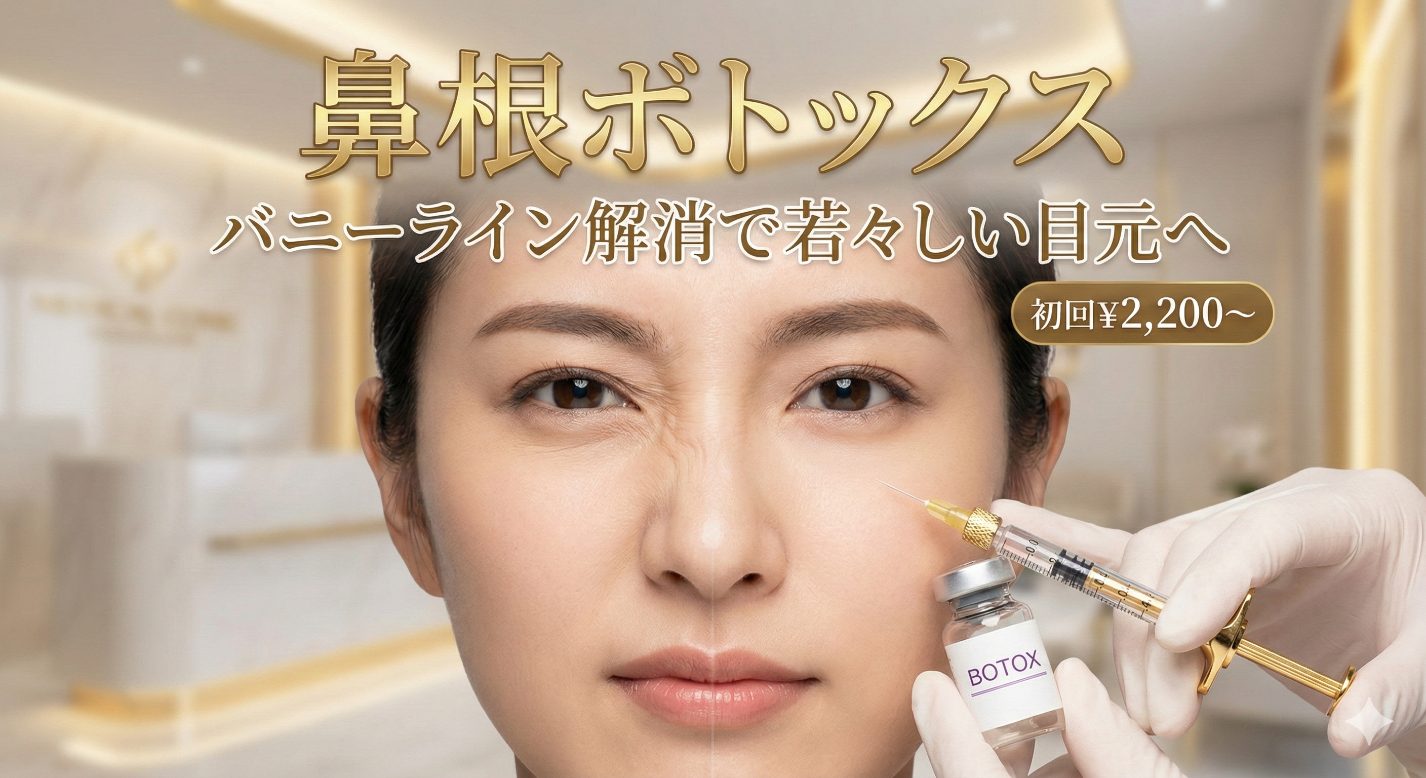 鼻根ボトックス