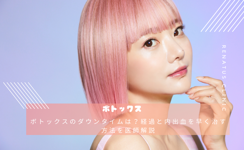 ボトックスのダウンタイムは?経過と内出血を早く治す方法を医師解説