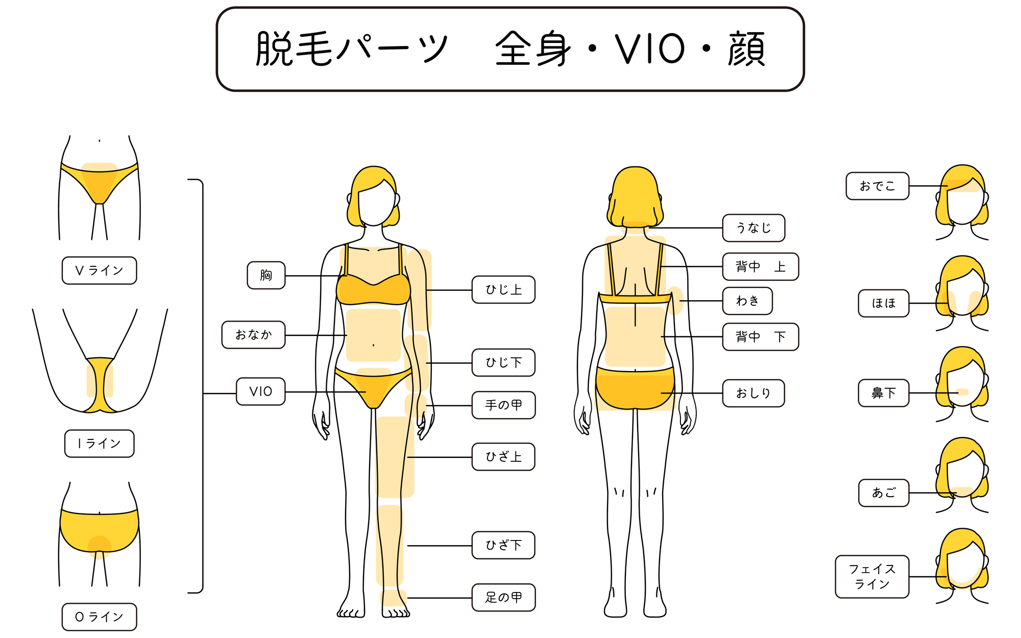 医療脱毛の脱毛パーツ図（全身・VIO・顔の部位一覧：Vライン・Iライン・Oライン、ひじ上/下・ひざ上/下・手足の甲、おでこ・ほほ・鼻下・あご・フェイスラインまで）
