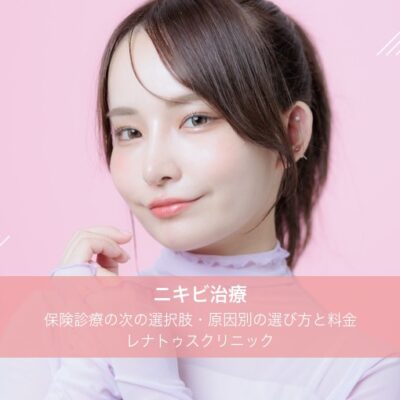ニキビ治療|保険診療の次の選択肢・原因別の選び方と料金|レナトゥスクリニック 8 ニキビ治療|レナトゥスクリニック